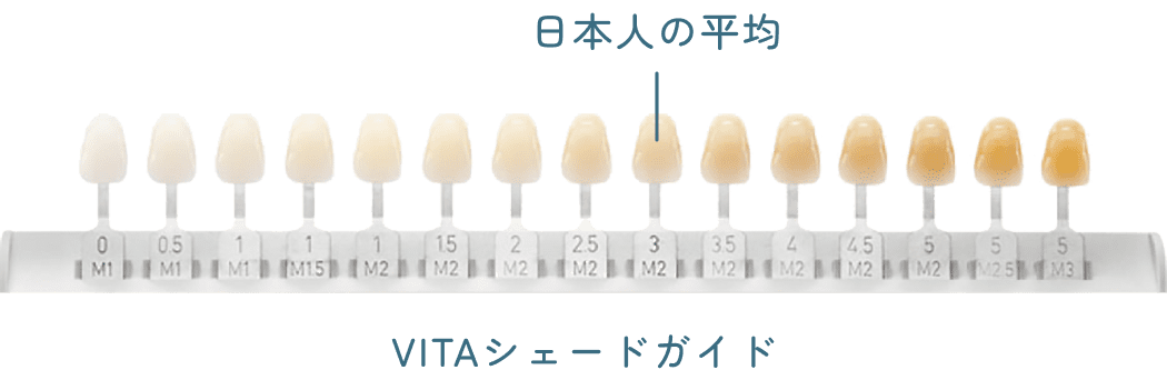 VITAシェードガイド(歯の色見本)と日本人の歯の平均的な色味